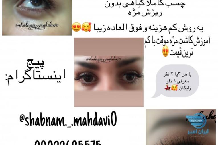 کاشت مژه موقت 