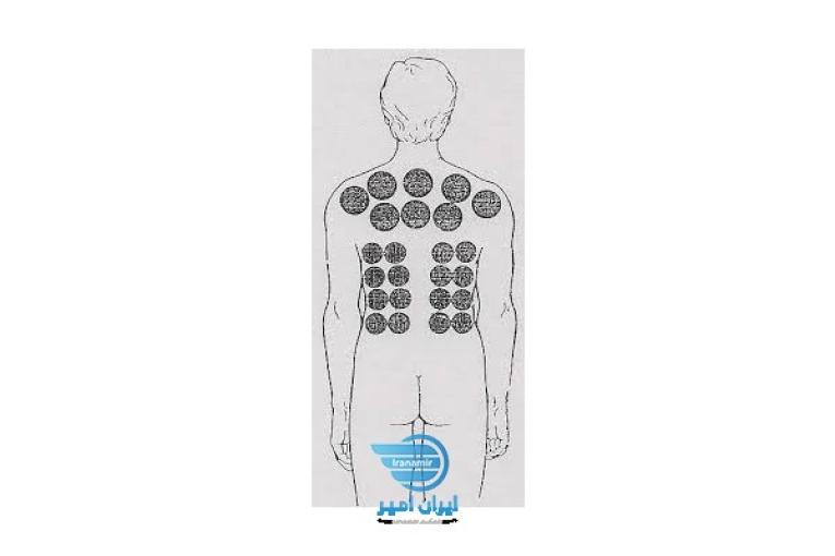 بادکش کامل بدن