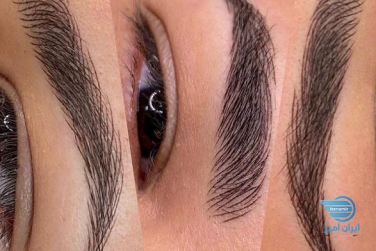 فیبروز، میکروپیگمنتیشن، آرایش دائم صورت بانوان