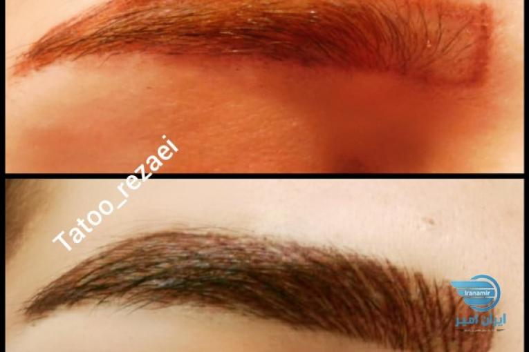 ارایش دائم صورت(تتو صورت و تتو بدن)