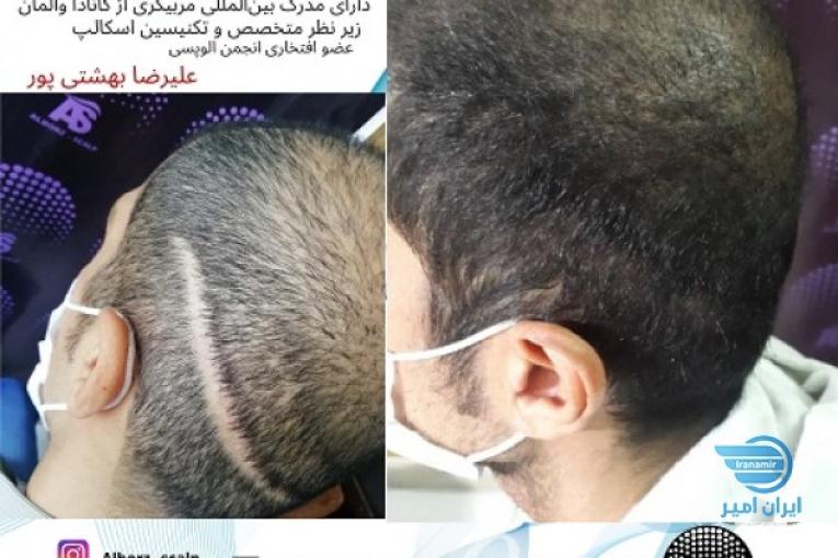 مرکز تخصص اسکالپ کرج(علیرضا بهشتی پور)
