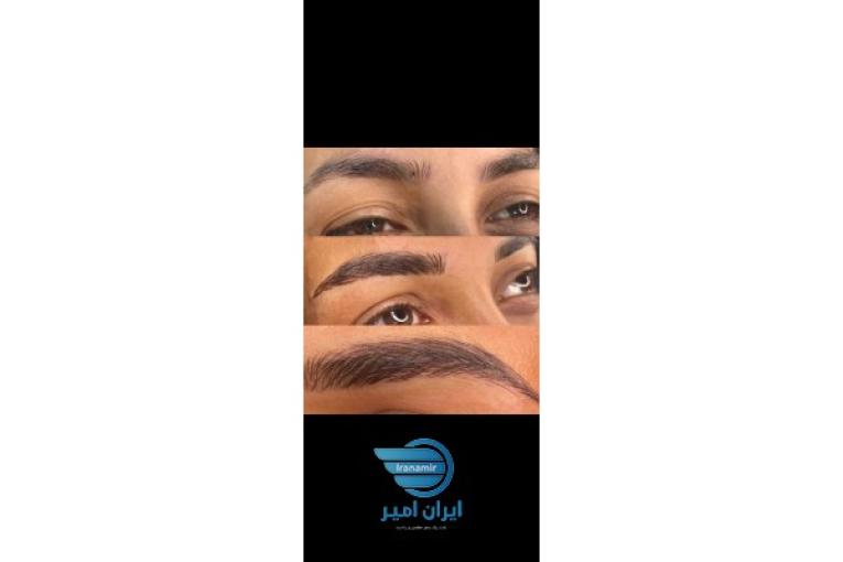 میکروپگمنتیشن