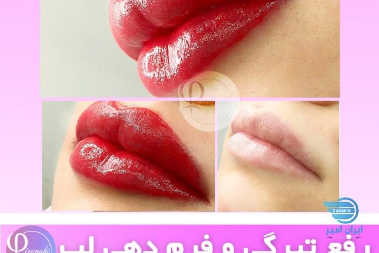 مرکز تخصصی زیبایی ایران فی