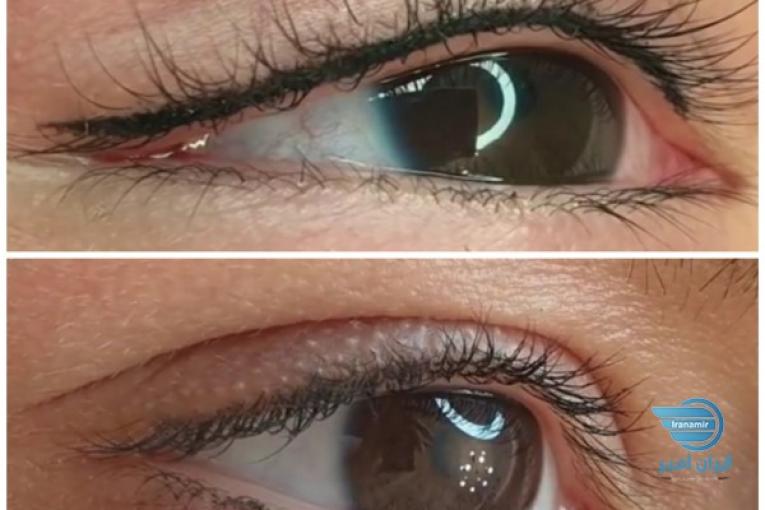 انجام تتو حرفه ای صورت وآموزش