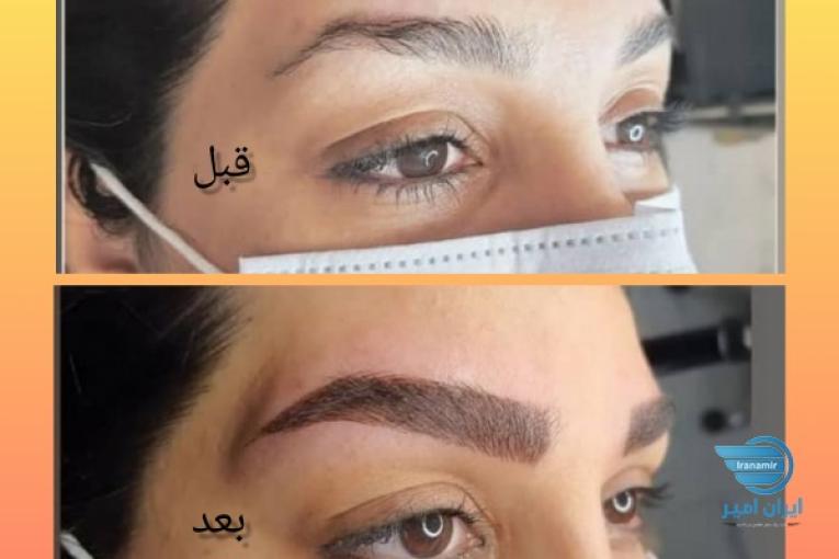 مدل فیبروز ابرو