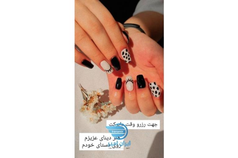 آفر ویژه کاشت ناخن 