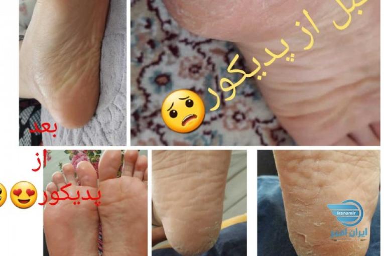 پدیکور و کف سابی سیار در پرند و رباط کریم