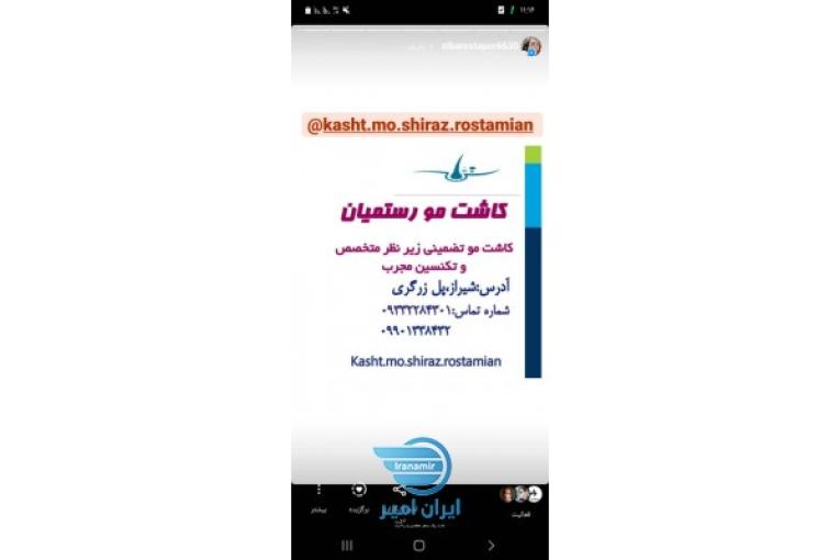 کاشت مو با تراکم بالا و قیمت مناسب و تضمینی