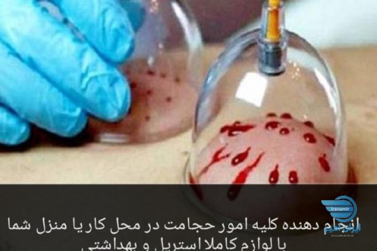 حجامت و بادکش تخصص ماست
