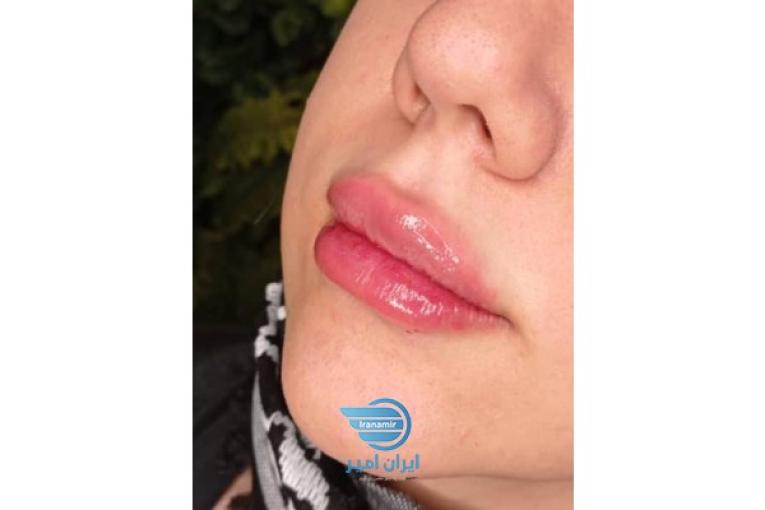 کلینیک‌لیزر و زیبایی ونوس طلایی 