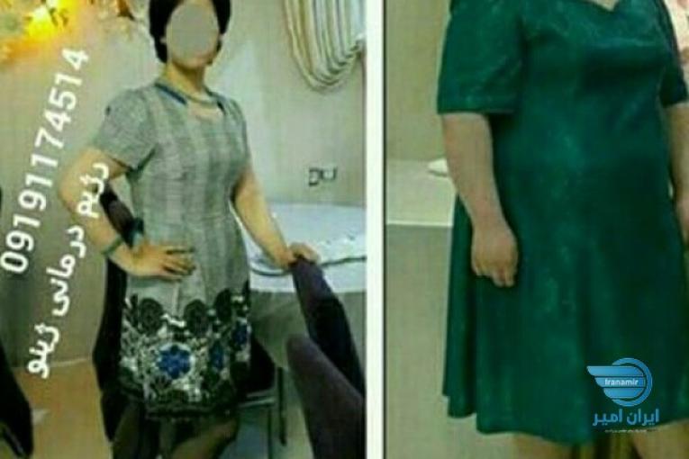 رژیم درمانی فازسه