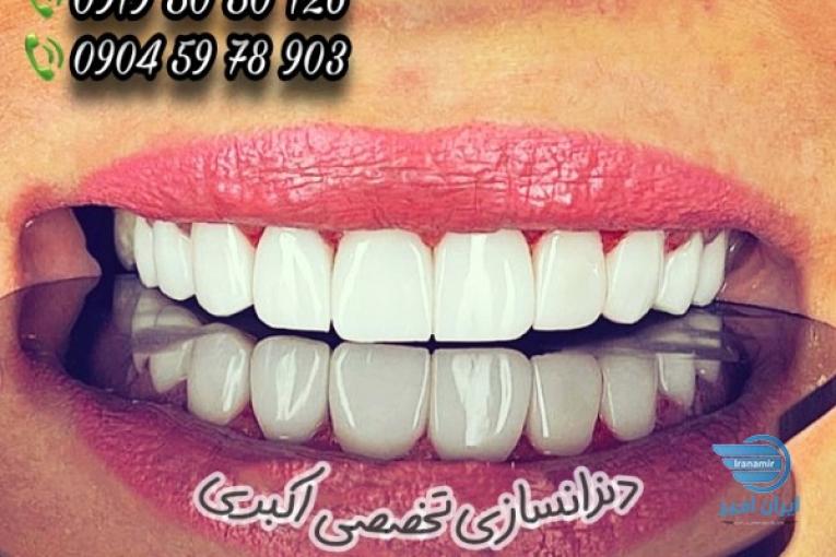 دندانسازی‌تخصصی(بدون نیاز به ایمپلنت وجراحی دندان داشته باشی)متخصص ساخت تمام پروتزهای دندانی