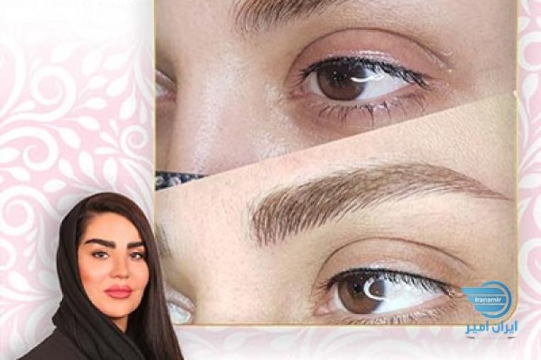 میکروبلیدینگ ابرو در شرق تهران باکیفیت عالی