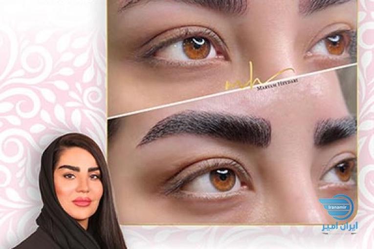 بهترین مرکز فیبروز ابرو درشرق تهران با مریم حیدری