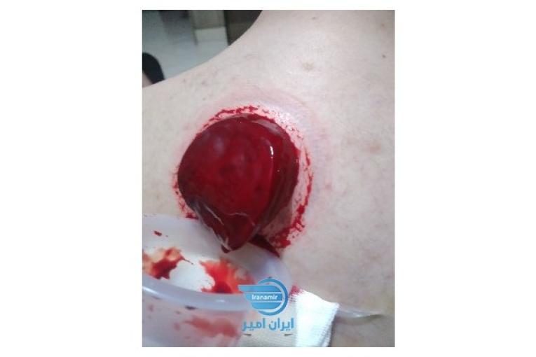 وصل سرم، خدمات پزشکی در منزل