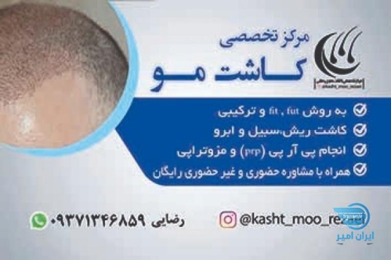 کاشت مو و زیبایی