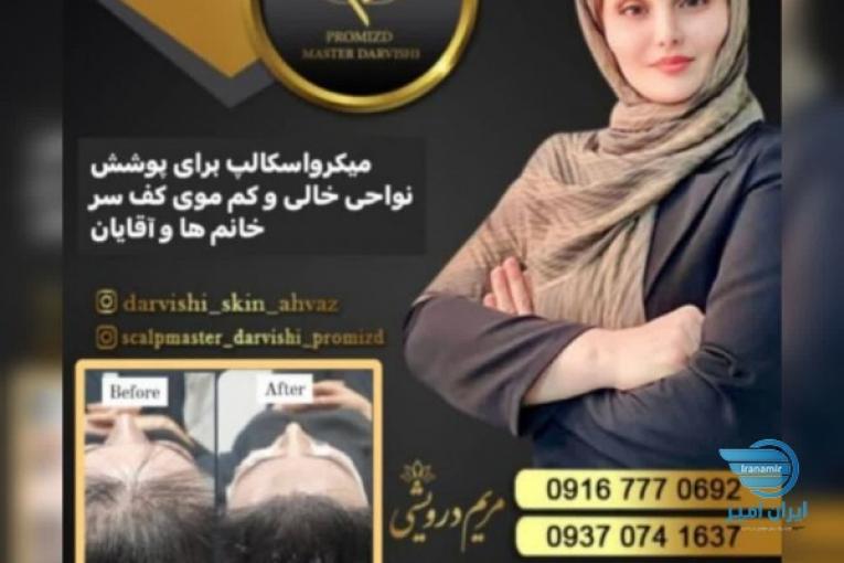     میکرواسکالپ  سر