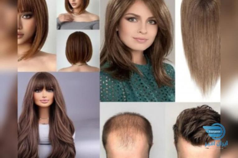 ماد مو اولین و تنها تولید کننده پروتز مو و پوستیژ و کلاه گیس