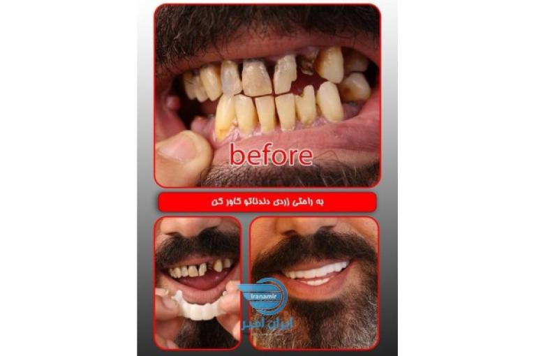لمینت متحرک ترو اسمایل