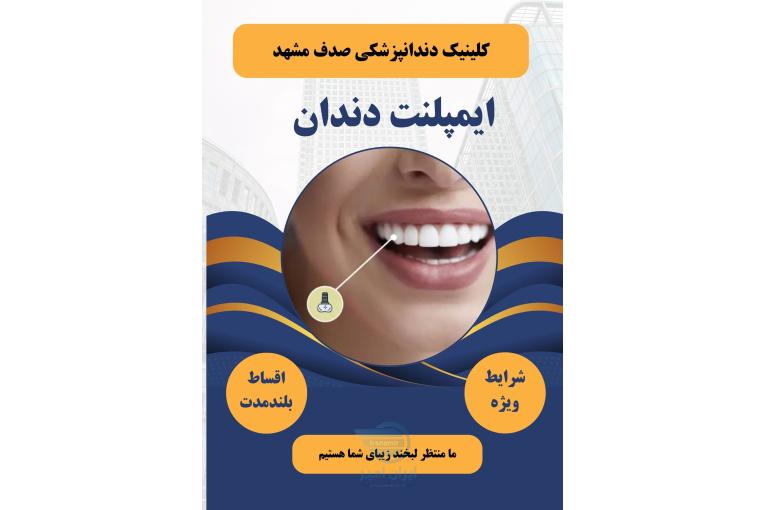 ایمپلنت دندان در مشهد با اقساط بلند مدت، بدون پیش پرداخت ( دیگه نگران هزینه‌ها نباش )