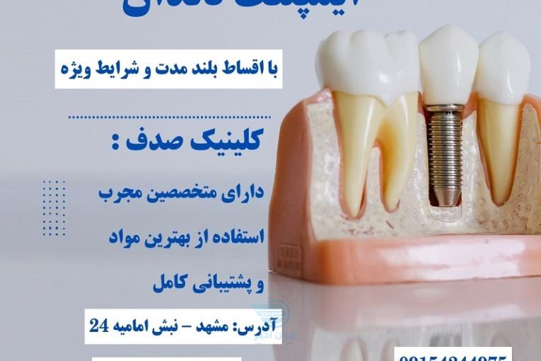 درمان ایمپلنت بدون فشار مالی با اقساط بلند مدت