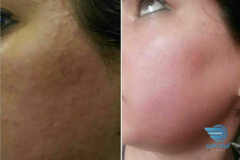 پاکسازی و فیشیال پوست در کلینیک پزشکی