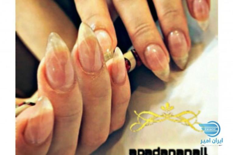 تخفیف ویژه کاشت ناخن