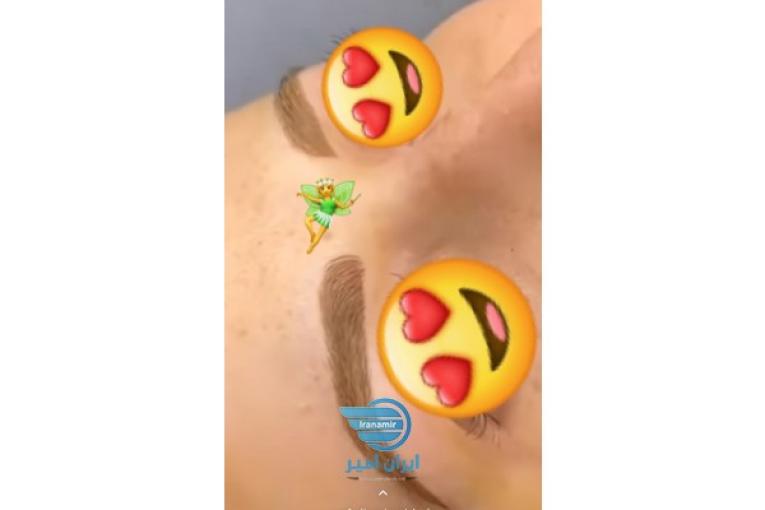 تخفیف استثنایی خدمات تاتو و نانو فیبروز