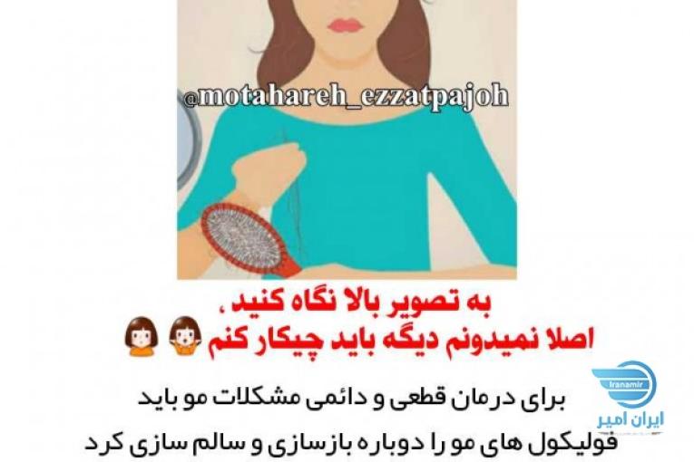 قطع ریزش موها