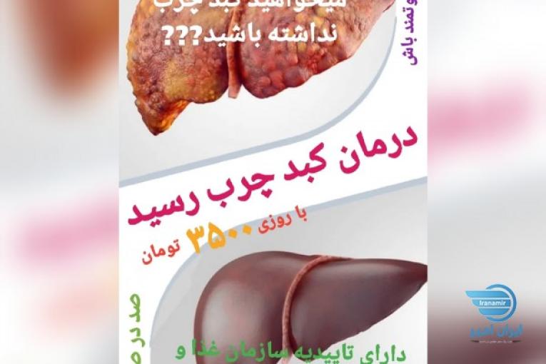 درمان قطعی کبد چرب