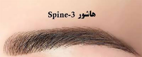 فیبروز ابرو؛ انواع و هزینه‌ی آن