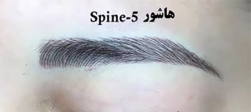 فیبروز ابرو؛ انواع و هزینه‌ی آن