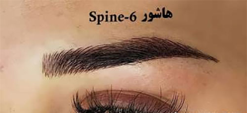 فیبروز ابرو؛ انواع و هزینه‌ی آن