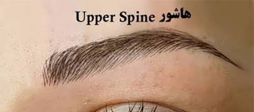 فیبروز ابرو؛ انواع و هزینه‌ی آن
