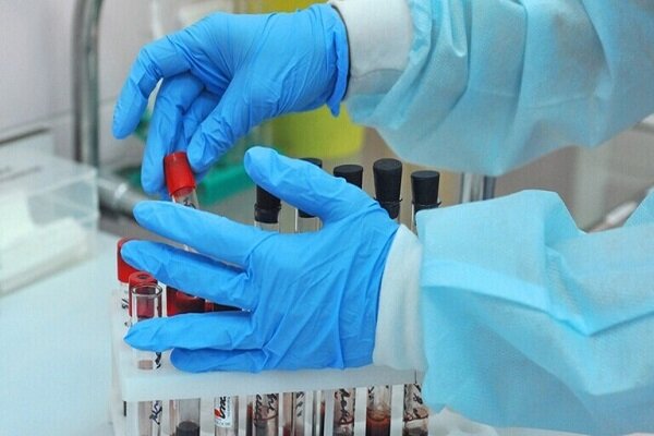 مراکز نقاهتگاهی در شهر ایلام راه اندازی می شود
