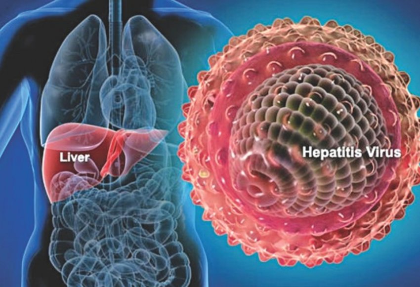 ایران متعهد است تا ۱۴۱۰ هپاتیت های ویروسی را حذف کند