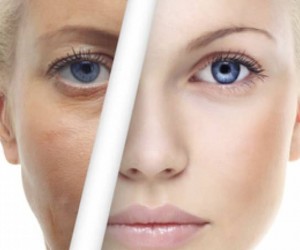 مزوژل در جوانسازی پوست فایده بسیار زیادی دارد
